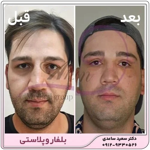 پزشکی