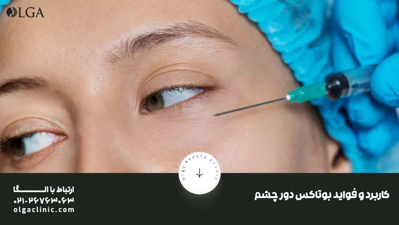 بوتاکس