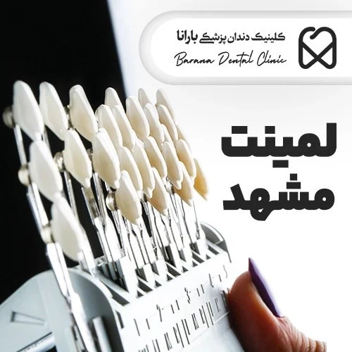 لمینت دندان